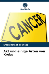 Akt und einige Arten von Krebs