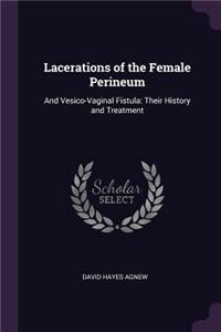 Lacerations of the Female Perineum