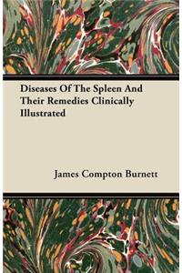 Diseases Of The Spleen And Their Remedies Clinically Illustrated