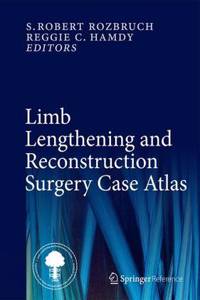 Limb Lengthening and Reconstruction Surgery Case Atlas