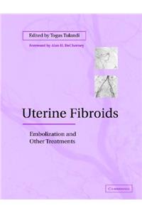 Uterine Fibroids