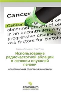 Ispol'zovanie Radiochastotnoy Ablatsii V Lechenii Opukholey Pecheni