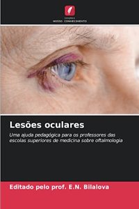 Lesões oculares