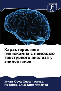 &#1061;&#1072;&#1088;&#1072;&#1082;&#1090;&#1077;&#1088;&#1080;&#1089;&#1090;&#1080;&#1082;&#1072; &#1075;&#1080;&#1087;&#1087;&#1086;&#1082;&#1072;&#1084;&#1087;&#1072; &#1089; &#1087;&#1086;&#1084;&#1086;&#1097;&#1100;&#1102; &#1090;&#1077;&#1082