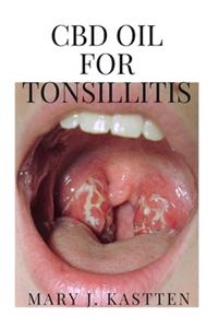 CBD Oil for Tonsillitis