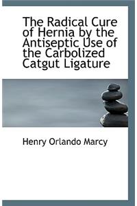 The Radical Cure of Hernia by the Antiseptic Use of the Carbolized Catgut Ligature
