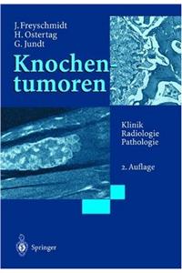 Knochentumoren Mit Kiefertumoren