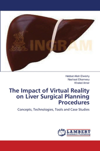 Impact of Virtual Reality on Liver Surgical Planning Procedures