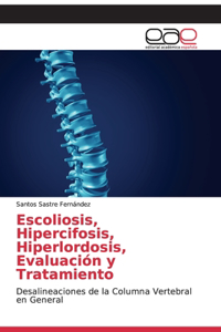Escoliosis, Hipercifosis, Hiperlordosis, Evaluación y Tratamiento
