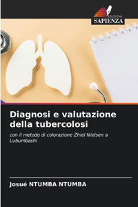 Diagnosi e valutazione della tubercolosi