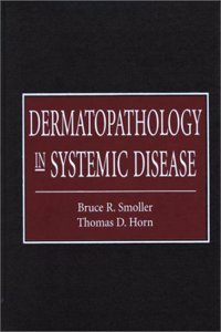 Dermatopathology in Systemic Disease