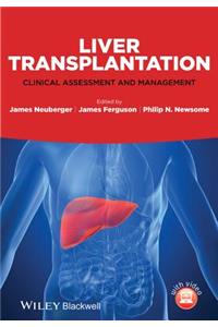 Liver Transplantation