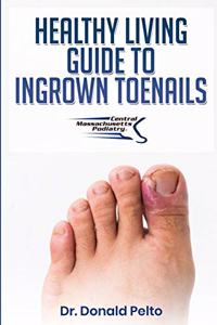 Healthy Living Guide to Ingrown Toenails