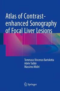 Atlas of Contrast-Enhanced Sonography of Focal Liver Lesions