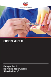 Open Apex