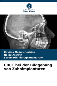 CBCT bei der Bildgebung von Zahnimplantaten
