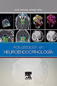Actualizacion en Neuroendocrinologia
