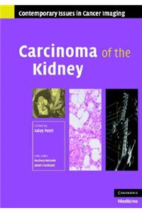 Carcinoma of the Kidney