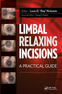 Limbal Relaxing Incisions