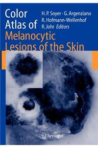 Color Atlas of Melanocytic Lesions of the Skin