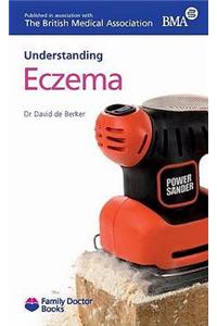 Understanding Eczema