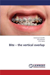 Bite - The Vertical Overlap