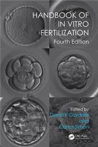 Handbook of In Vitro Fertilization