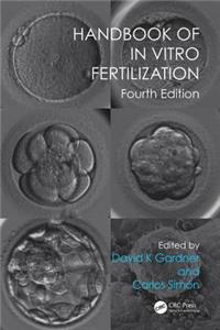 Handbook of in Vitro Fertilization