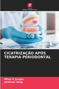 Cicatrização Após Terapia Periodontal