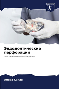 Эндодонтические перфорации