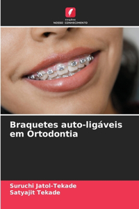 Braquetes auto-ligáveis em Ortodontia