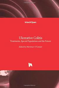 Ulcerative Colitis