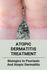 Atopic Dermatitis Treatment