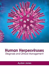 Human Herpesviruses: Diagnosis and Clinical Management