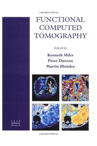 Functional Computed Tomography