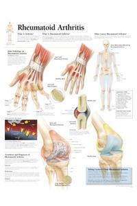 Rheumatoid Arthritis Laminated Poster