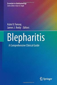 Blepharitis
