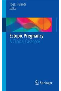 Ectopic Pregnancy