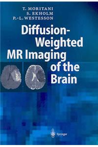 Diffusion- Weighted MR Imaging of the Brain