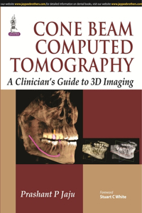 Cone Beam Computed Tomography