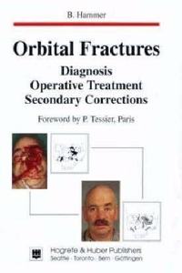 Orbital Fractures