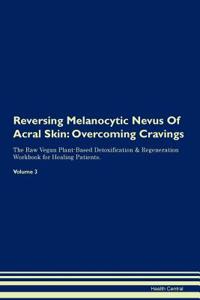 Reversing Melanocytic Nevus Of Acral Skin