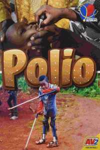 Polio