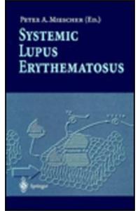 Systemic Lupus Erythematosus
