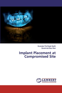 Implant Placement at Compromised Site