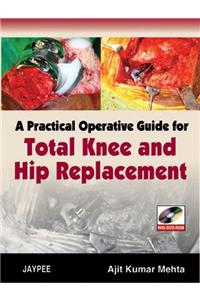 A Practical Operative Guide for Total Knee and Hip Replacement (with DVD-ROM)