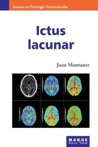 Ictus lacunar