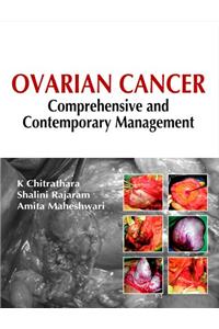 OVARIAN CANCER COMPREHENSIVE CONTEMPORA