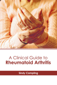 Clinical Guide to Rheumatoid Arthritis