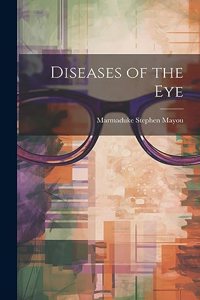 Diseases of the Eye